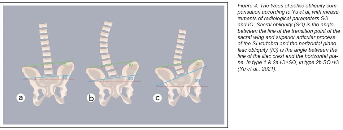 Postural stability and the effects of wheelchair cushions - Pelvic ...