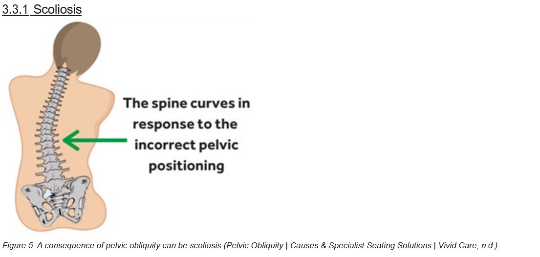 Postural stability and the effects of wheelchair cushions Pelvic